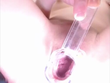 Thumb 1